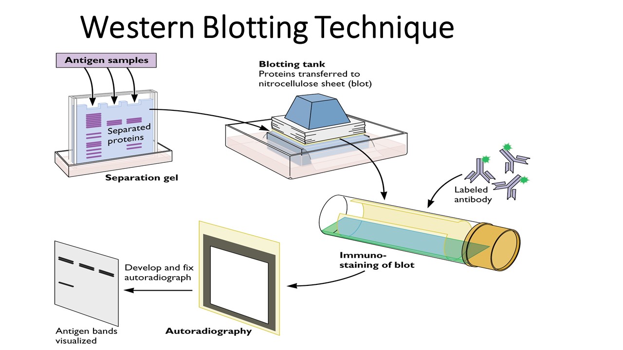 WB(Western Blotting)實驗方法